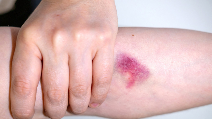 Мать избитого в Ачинске обувной ложкой подростка раскрыла детали произошедшего